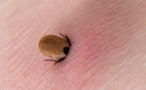 Do you know how to remove a tick properly?