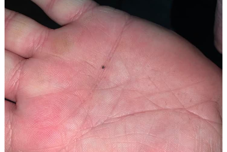 are ticks getting smaller